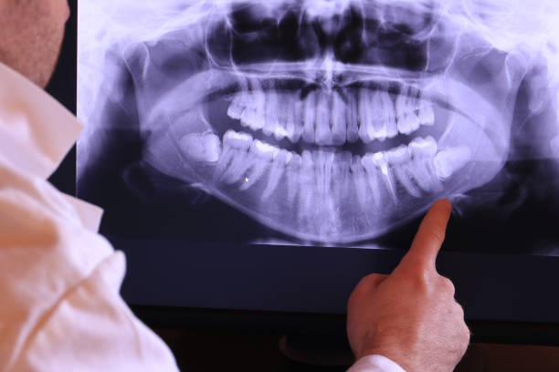 Best Emergency Dental Services for Seniors in Ridgely, TN